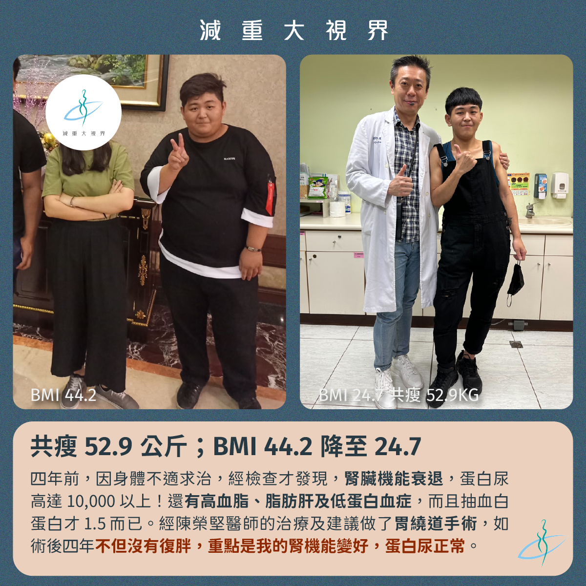 胃繞道手術-病友見證-減重大視界-瘦了52.9kg-陳榮堅醫師